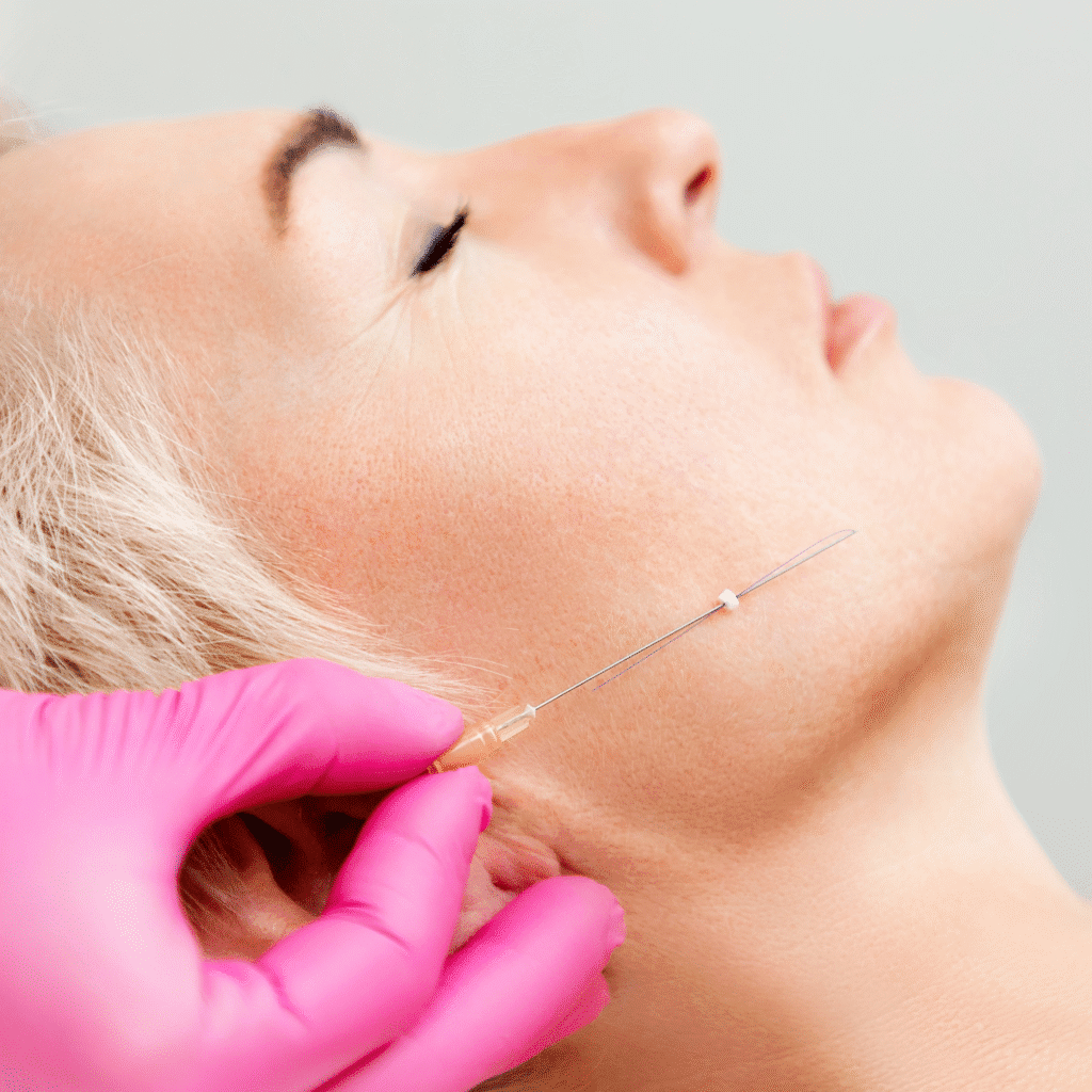 A close-up of a woman’s face as a person wearing pink gloves inserts a thin needle into her cheek, suggesting a medycyna estetyczna Wrocław procedure. The woman appears relaxed with eyes closed during the treatment.
