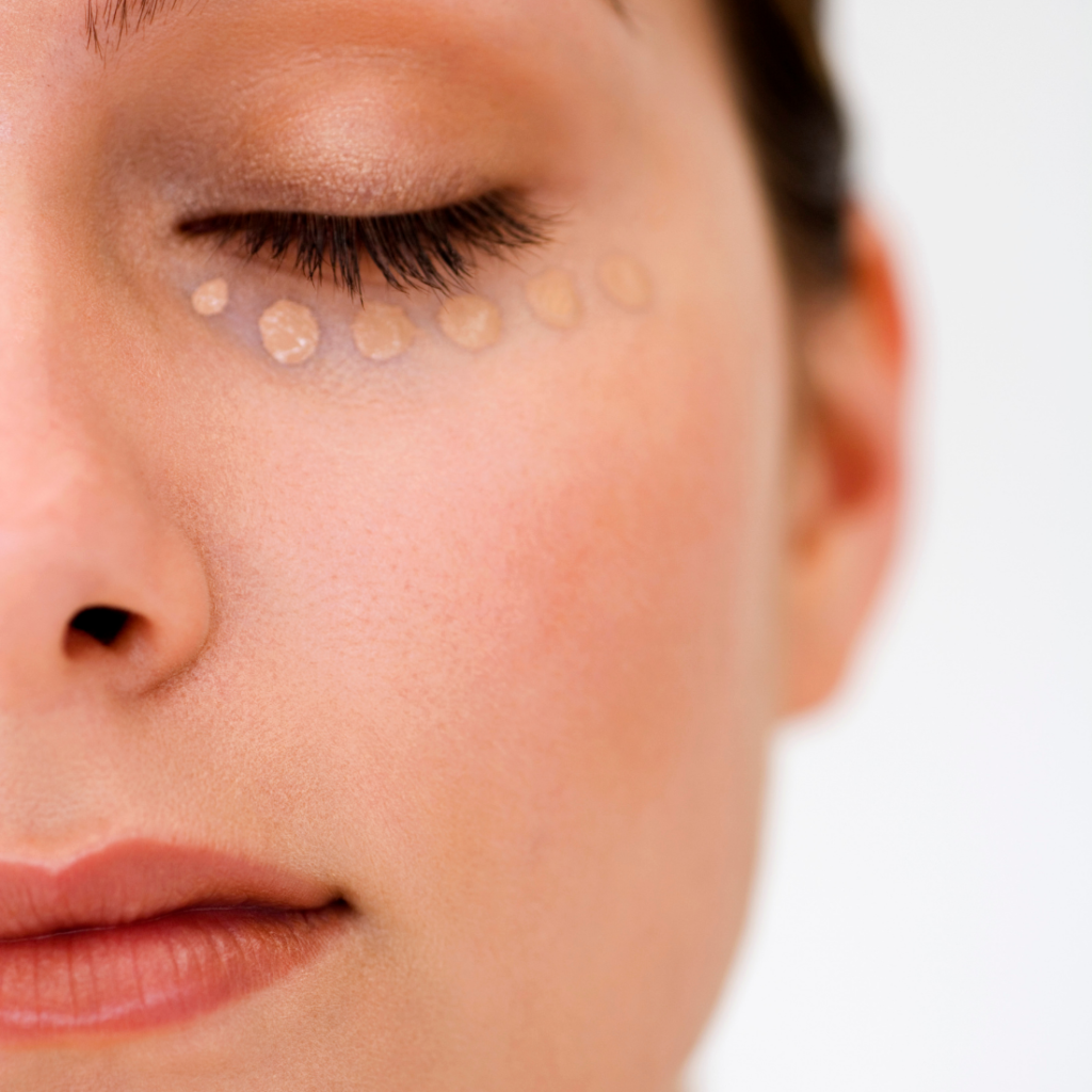 cieni pod oczami Wrocław | Illustre Clinic