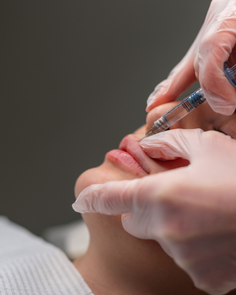 asymetria ust po powiększaniu, asymetria ust po kwasie hialuronowym,nierówne usta po powiększaniu, nierówne usta po kwasie hialuronowym, korekta asymetrii ust, korekta ust po kwasie hialuronowym, dlaczego usta po powiększaniu są nierówne, czy asymetria ust po powiększaniu jest normalna, kiedy zrobić korektę ust po kwasie, jak poprawić asymetrię ust, modelowanie ust kwasem hialuronowym, powiększanie ust kwasem hialuronowym, korekta ust po zabiegu, kontur ust po powiększaniu, łuk kupidyna, migracja kwasu w ustach, asymetria ust Wrocław, korekta ust Wrocław, korekta asymetrii ust Wrocław, powiększanie ust Wrocław, kwas hialuronowy usta Wrocław